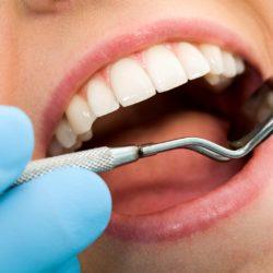 Протезирование зубов. Стоматология Артиго